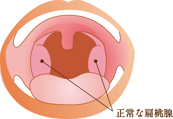舌扁桃の図